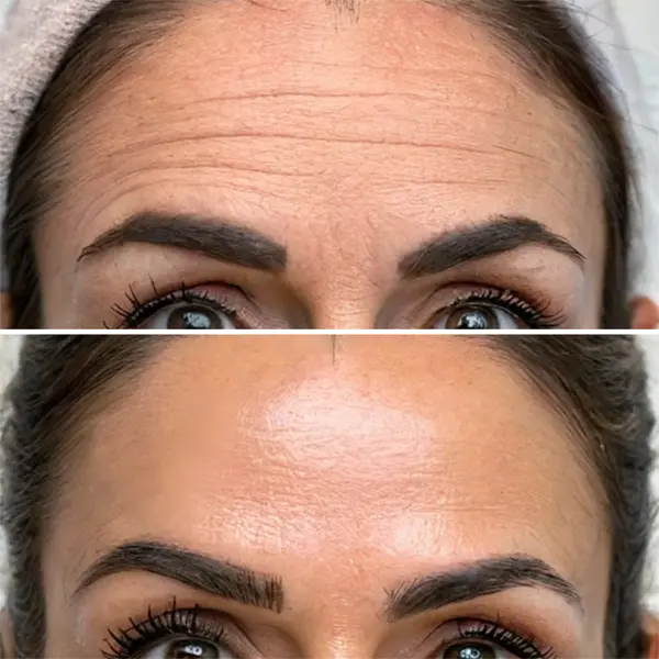 Wrinkle Relaxer