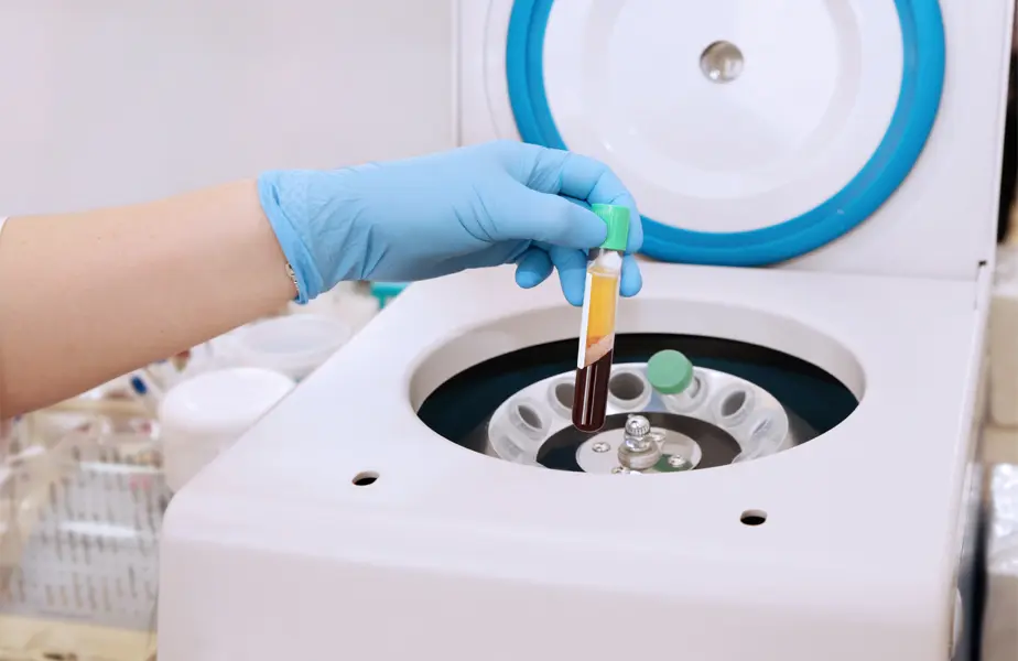 PRP Scar Treatment by The Cosmetic Clinic in Greenwich, CT