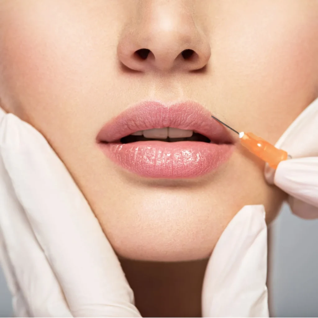 Women getting an injection in upper lip
