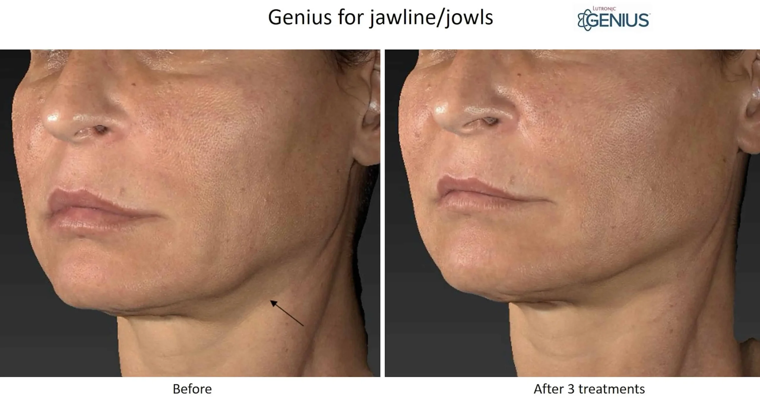scaled by The Cosmetic Clinic in Greenwich, CT
